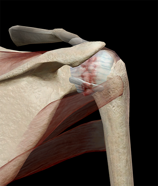 articular-capsule-adhesive-capsulitis